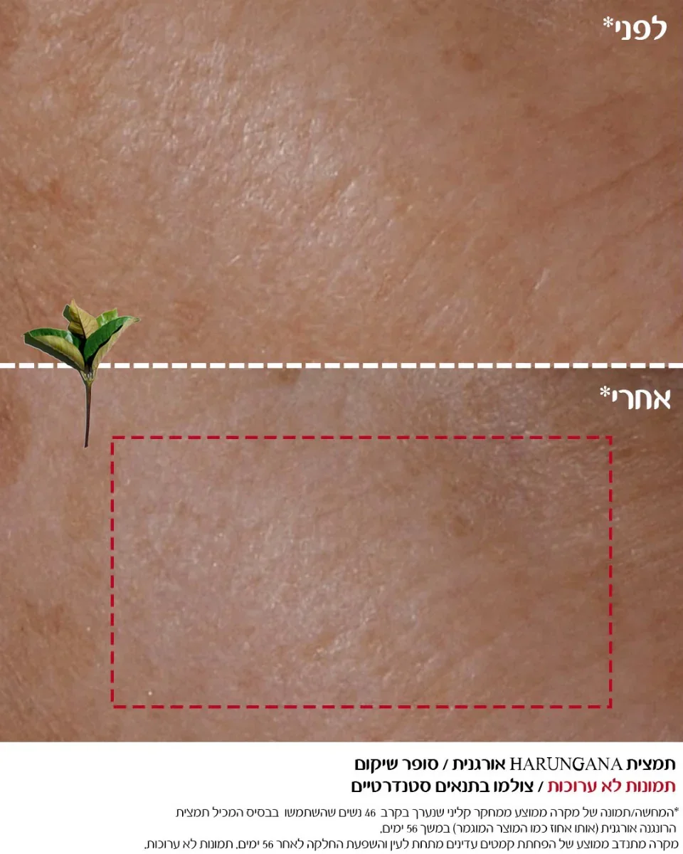 תמונה ממוזערת 5