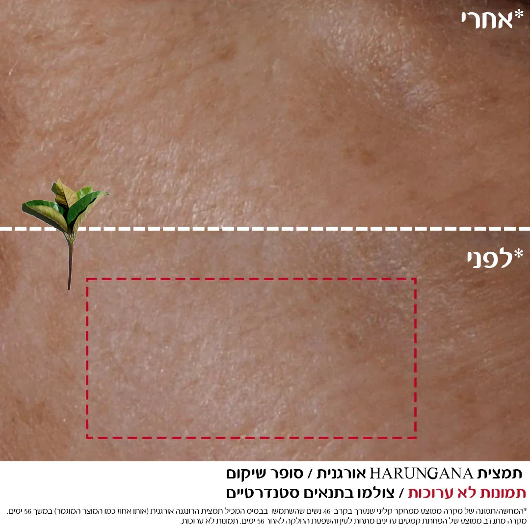 תמונה ממוזערת 8